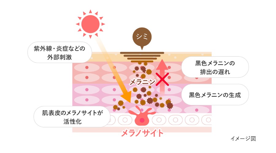 メラニン生成のメカニズムを示す図