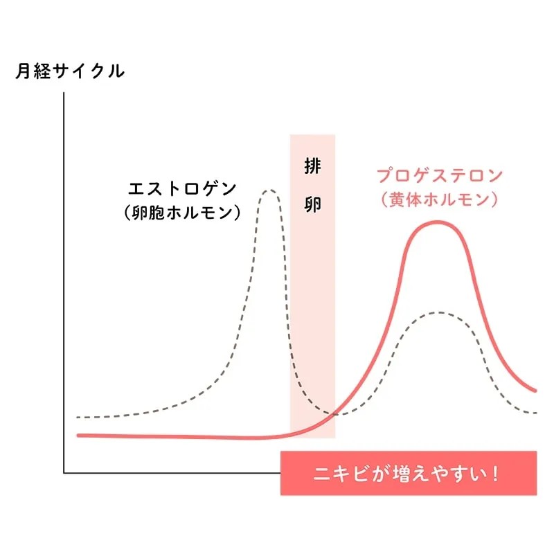 ニキビのできやすい位置を示した図