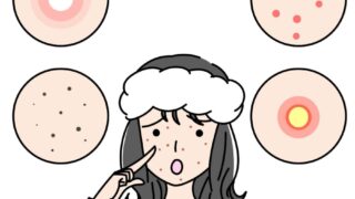 突然の白ニキビ大量発生!考えられる原因と正しい対処法を解説